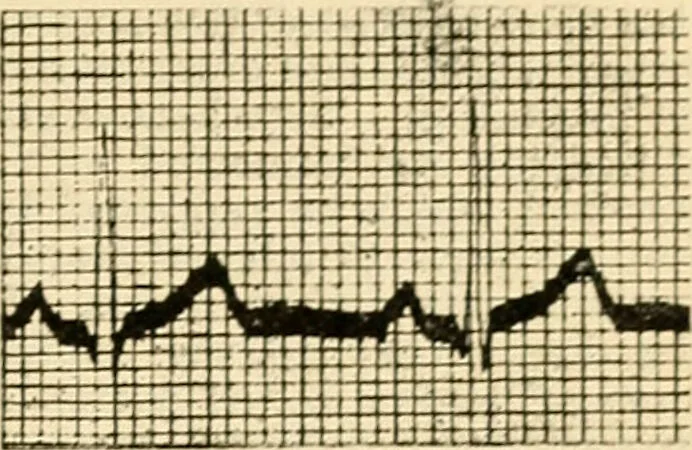 An illustration from A manual of physiology : with practical exercises / by G. N. Stewart ; with coloured plate and 467 other illustrations., 1914, leaf 833