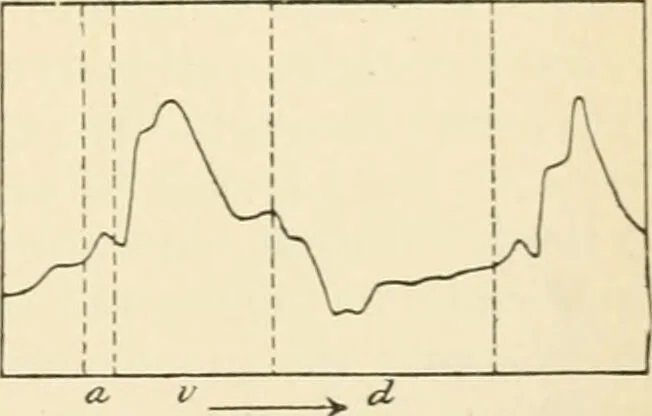 An illustration from Human physiology : prepared with special reference to students of medicine / by Joseph Howard Raymond., 1901, leaf 311
