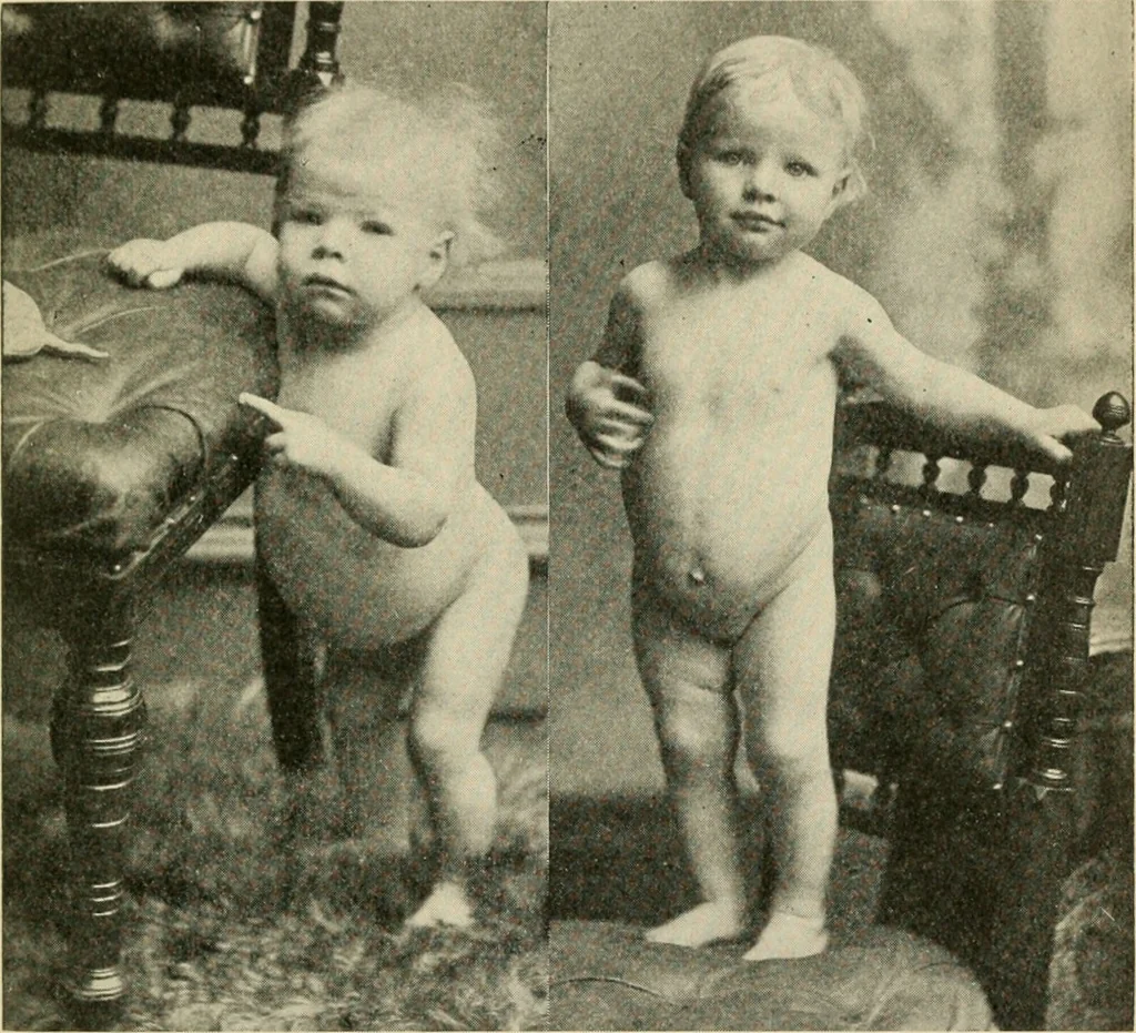 An illustration from Human physiology : prepared with special reference to students of medicine / by Joseph Howard Raymond., 1901, leaf 341