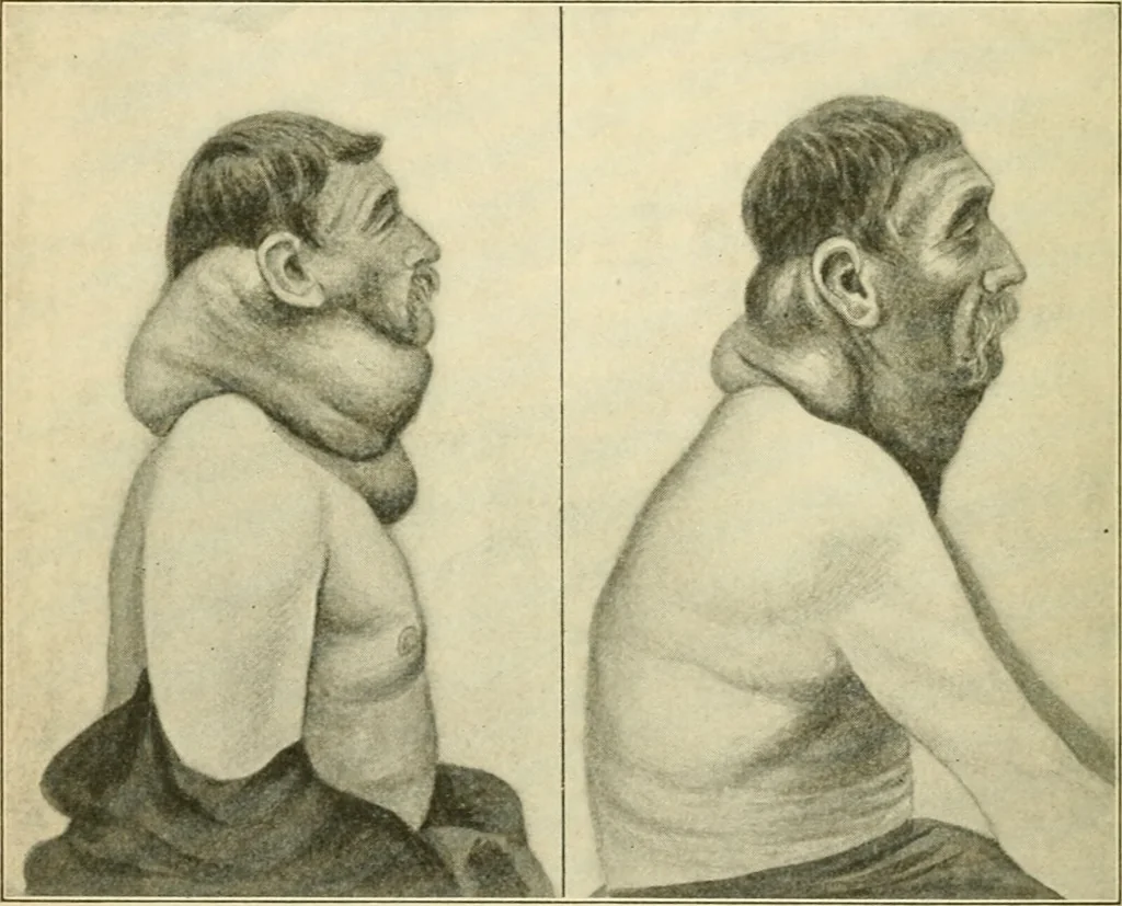 An illustration from Human physiology : prepared with special reference to students of medicine / by Joseph Howard Raymond., 1901, leaf 342