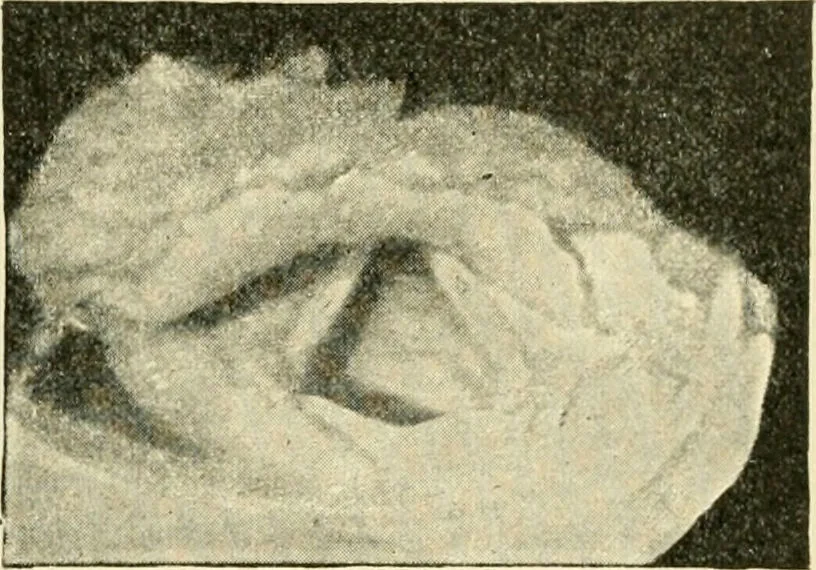 An illustration from Human physiology : prepared with special reference to students of medicine / by Joseph Howard Raymond., 1901, leaf 396