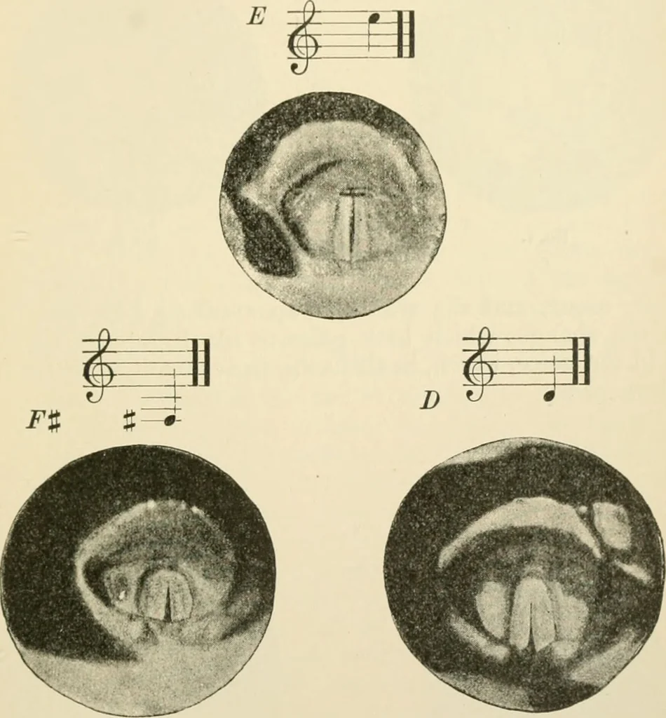 An illustration from Human physiology : prepared with special reference to students of medicine / by Joseph Howard Raymond., 1901, leaf 397