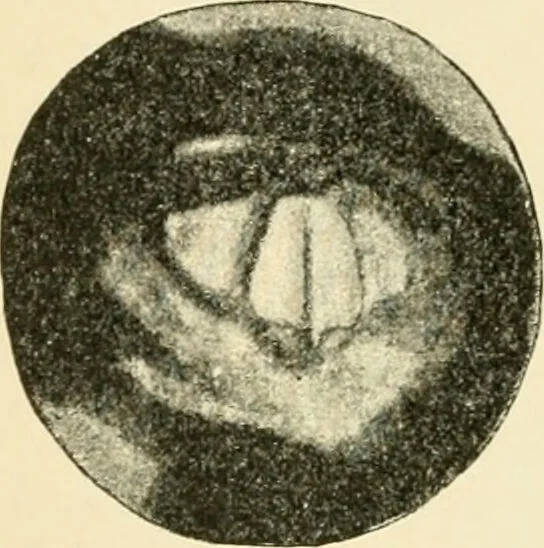 An illustration from Human physiology : prepared with special reference to students of medicine / by Joseph Howard Raymond., 1901, leaf 398