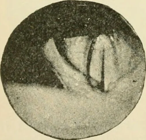 An illustration from Human physiology : prepared with special reference to students of medicine / by Joseph Howard Raymond., 1901, leaf 398