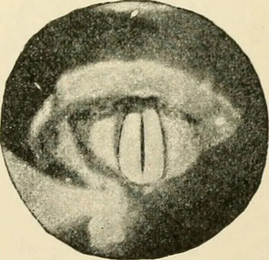 An illustration from Human physiology : prepared with special reference to students of medicine / by Joseph Howard Raymond., 1901, leaf 401