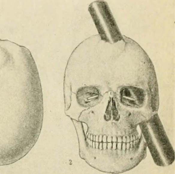 An illustration from Human physiology : prepared with special reference to students of medicine / by Joseph Howard Raymond., 1901, leaf 507