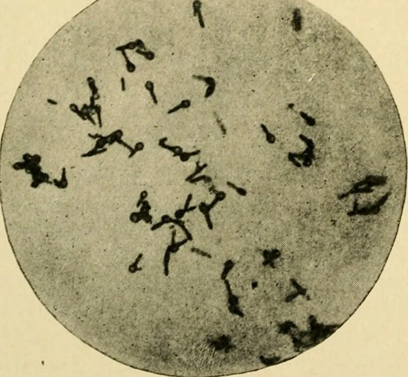 An illustration from The principles and practice of modern surgery / by Roswell Park ... with 722 engravings and 60 full-page plates in colors and monochrome., 1907, leaf 106