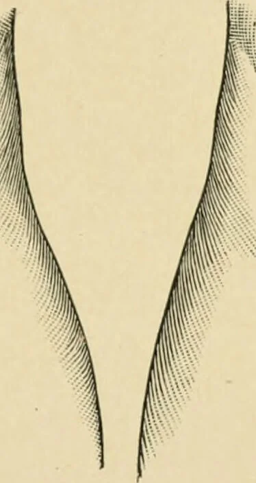 An illustration from The principles and practice of modern surgery / by Roswell Park ... with 722 engravings and 60 full-page plates in colors and monochrome., 1907, leaf 1093