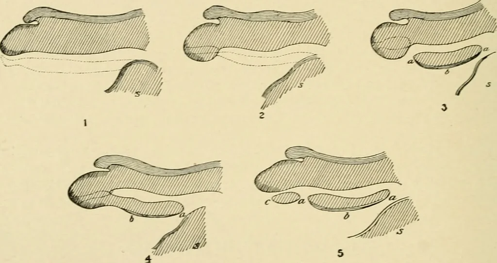 An illustration from The principles and practice of modern surgery / by Roswell Park ... with 722 engravings and 60 full-page plates in colors and monochrome., 1907, leaf 1120