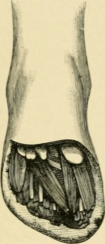 An illustration from The principles and practice of modern surgery / by Roswell Park ... with 722 engravings and 60 full-page plates in colors and monochrome., 1907, leaf 1156