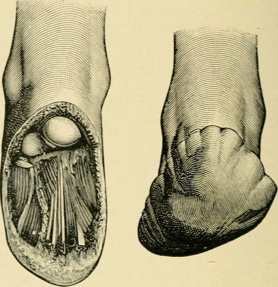An illustration from The principles and practice of modern surgery / by Roswell Park ... with 722 engravings and 60 full-page plates in colors and monochrome., 1907, leaf 1156