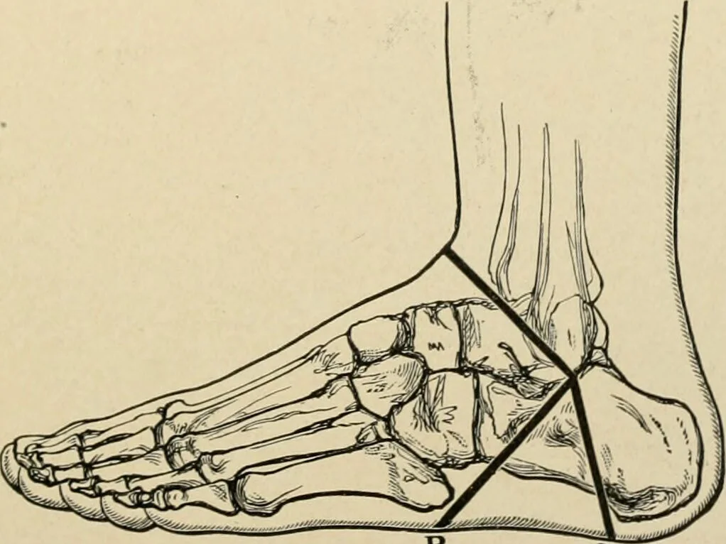 An illustration from The principles and practice of modern surgery / by Roswell Park ... with 722 engravings and 60 full-page plates in colors and monochrome., 1907, leaf 1157