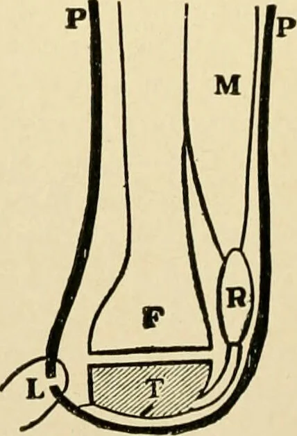 An illustration from The principles and practice of modern surgery / by Roswell Park ... with 722 engravings and 60 full-page plates in colors and monochrome., 1907, leaf 1162