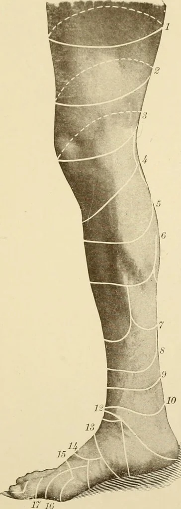 An illustration from The principles and practice of modern surgery / by Roswell Park ... with 722 engravings and 60 full-page plates in colors and monochrome., 1907, leaf 1165