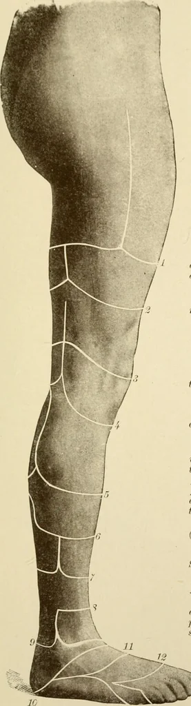 An illustration from The principles and practice of modern surgery / by Roswell Park ... with 722 engravings and 60 full-page plates in colors and monochrome., 1907, leaf 1167