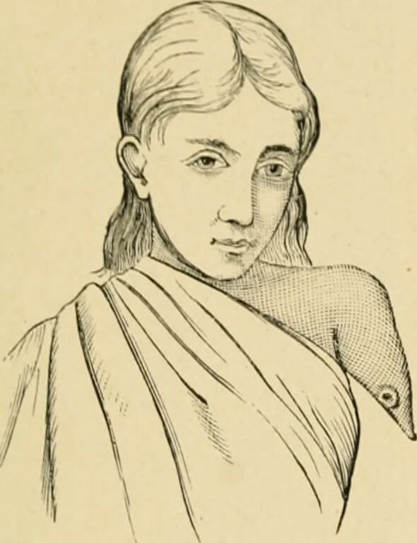An illustration from The principles and practice of modern surgery / by Roswell Park ... with 722 engravings and 60 full-page plates in colors and monochrome., 1907, leaf 1169