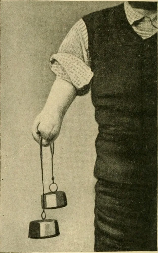 An illustration from The principles and practice of modern surgery / by Roswell Park ... with 722 engravings and 60 full-page plates in colors and monochrome., 1907, leaf 1170