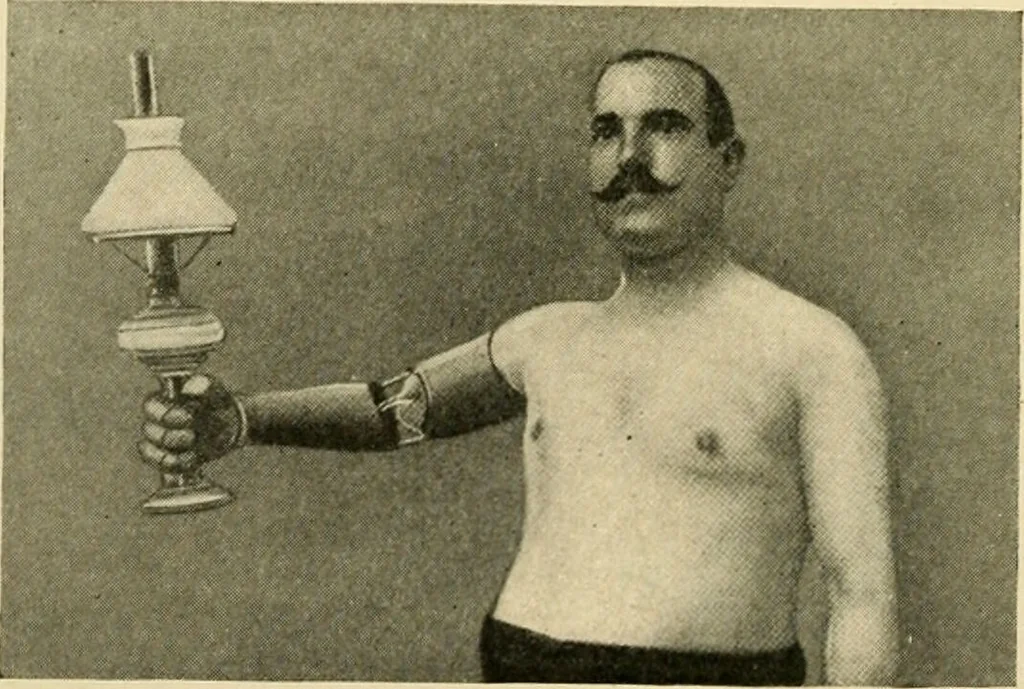 An illustration from The principles and practice of modern surgery / by Roswell Park ... with 722 engravings and 60 full-page plates in colors and monochrome., 1907, leaf 1170