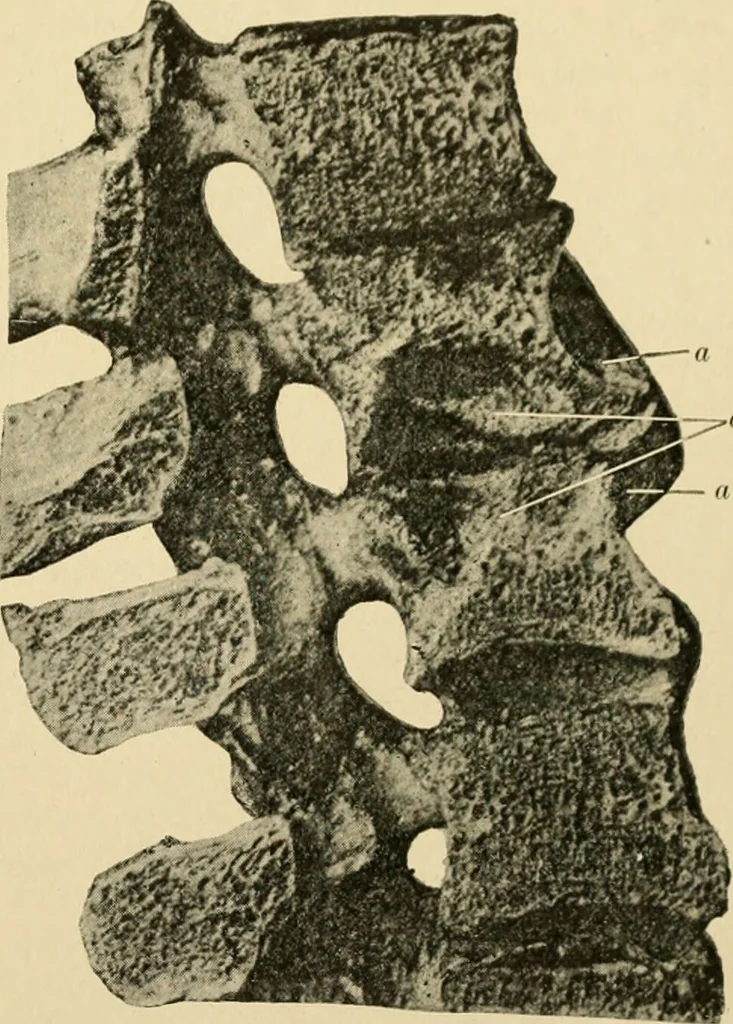 An illustration from The principles and practice of modern surgery / by Roswell Park ... with 722 engravings and 60 full-page plates in colors and monochrome., 1907, leaf 133