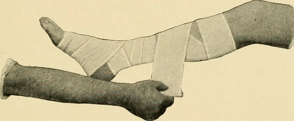 An illustration from The principles and practice of modern surgery / by Roswell Park ... with 722 engravings and 60 full-page plates in colors and monochrome., 1907, leaf 213