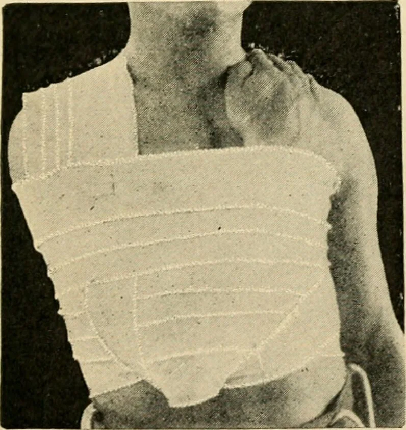 An illustration from The principles and practice of modern surgery / by Roswell Park ... with 722 engravings and 60 full-page plates in colors and monochrome., 1907, leaf 213
