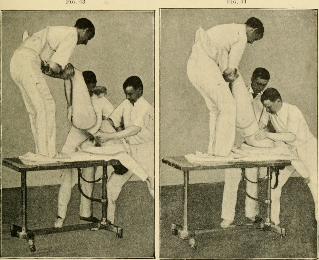 An illustration from The principles and practice of modern surgery / by Roswell Park ... with 722 engravings and 60 full-page plates in colors and monochrome., 1907, leaf 227
