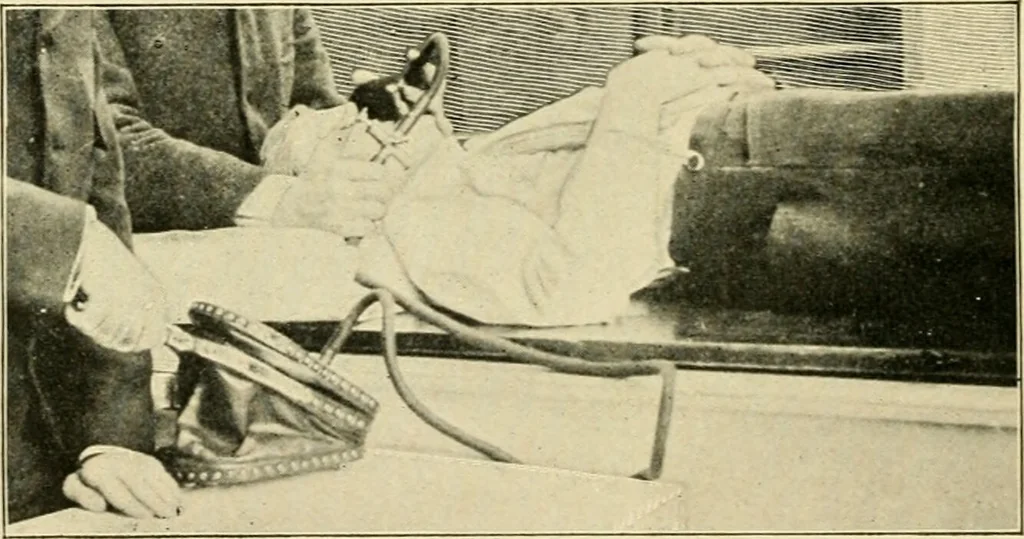An illustration from The principles and practice of modern surgery / by Roswell Park ... with 722 engravings and 60 full-page plates in colors and monochrome., 1907, leaf 228