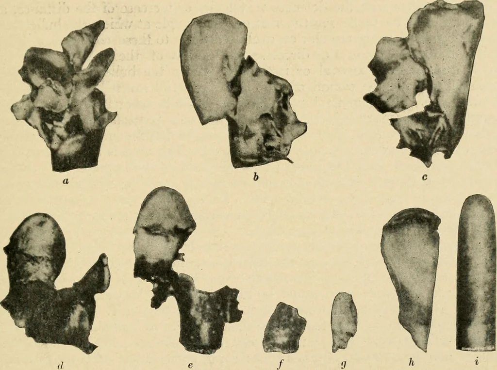 An illustration from The principles and practice of modern surgery / by Roswell Park ... with 722 engravings and 60 full-page plates in colors and monochrome., 1907, leaf 247