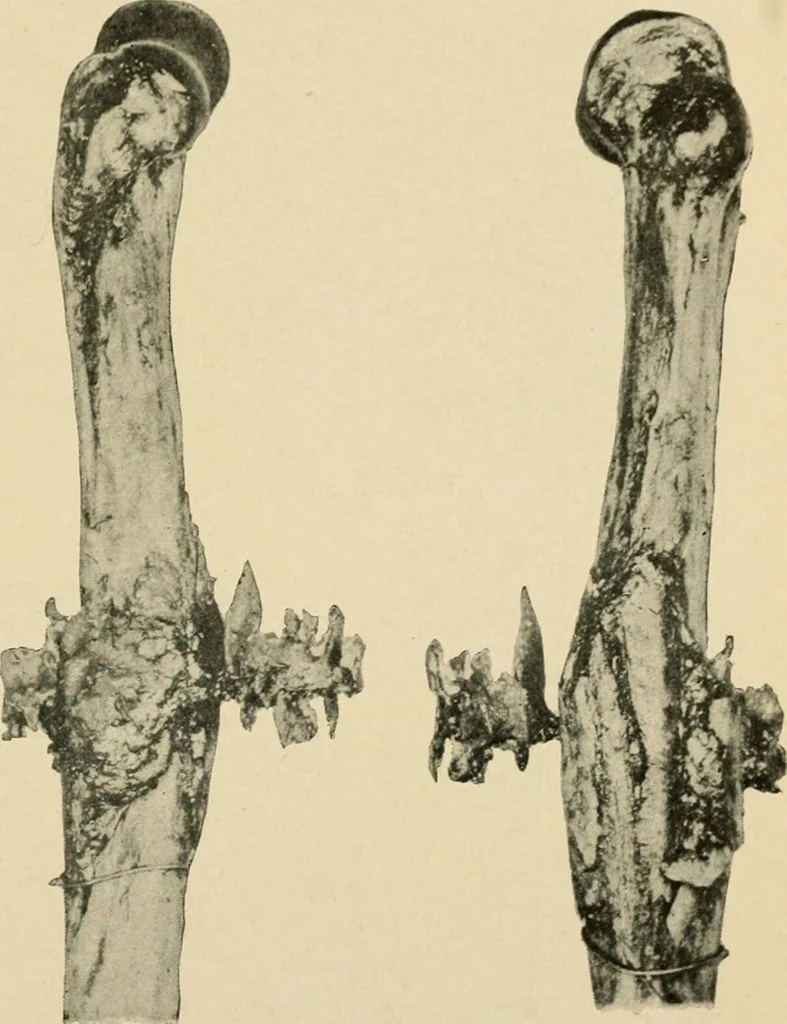 An illustration from The principles and practice of modern surgery / by Roswell Park ... with 722 engravings and 60 full-page plates in colors and monochrome., 1907, leaf 253