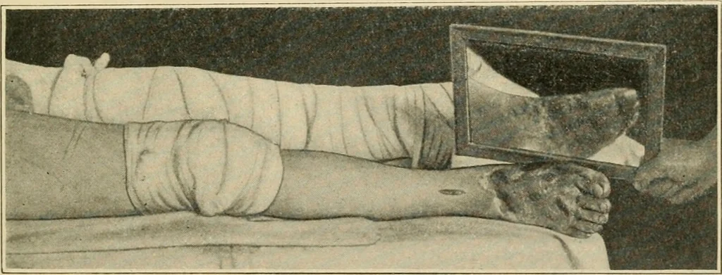 An illustration from The principles and practice of modern surgery / by Roswell Park ... with 722 engravings and 60 full-page plates in colors and monochrome., 1907, leaf 259