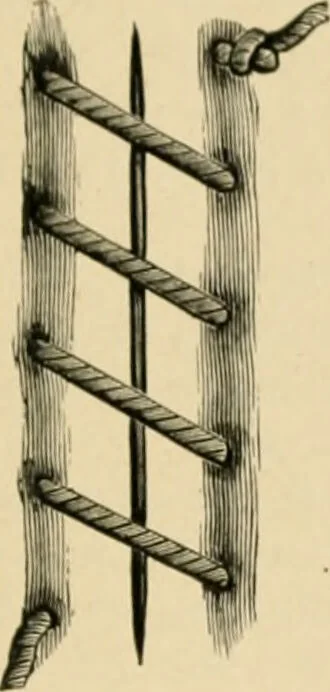 An illustration from The principles and practice of modern surgery / by Roswell Park ... with 722 engravings and 60 full-page plates in colors and monochrome., 1907, leaf 269