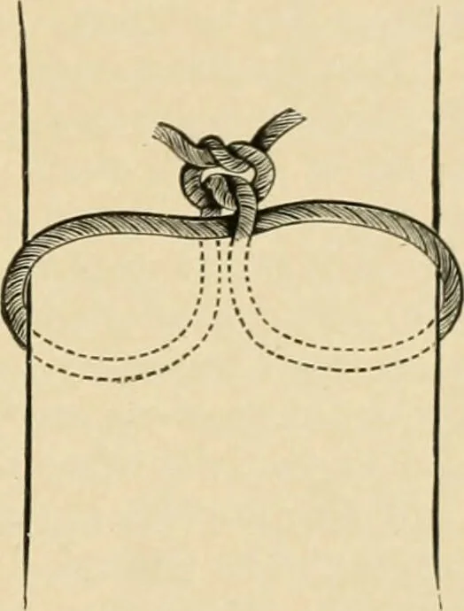 An illustration from The principles and practice of modern surgery / by Roswell Park ... with 722 engravings and 60 full-page plates in colors and monochrome., 1907, leaf 269