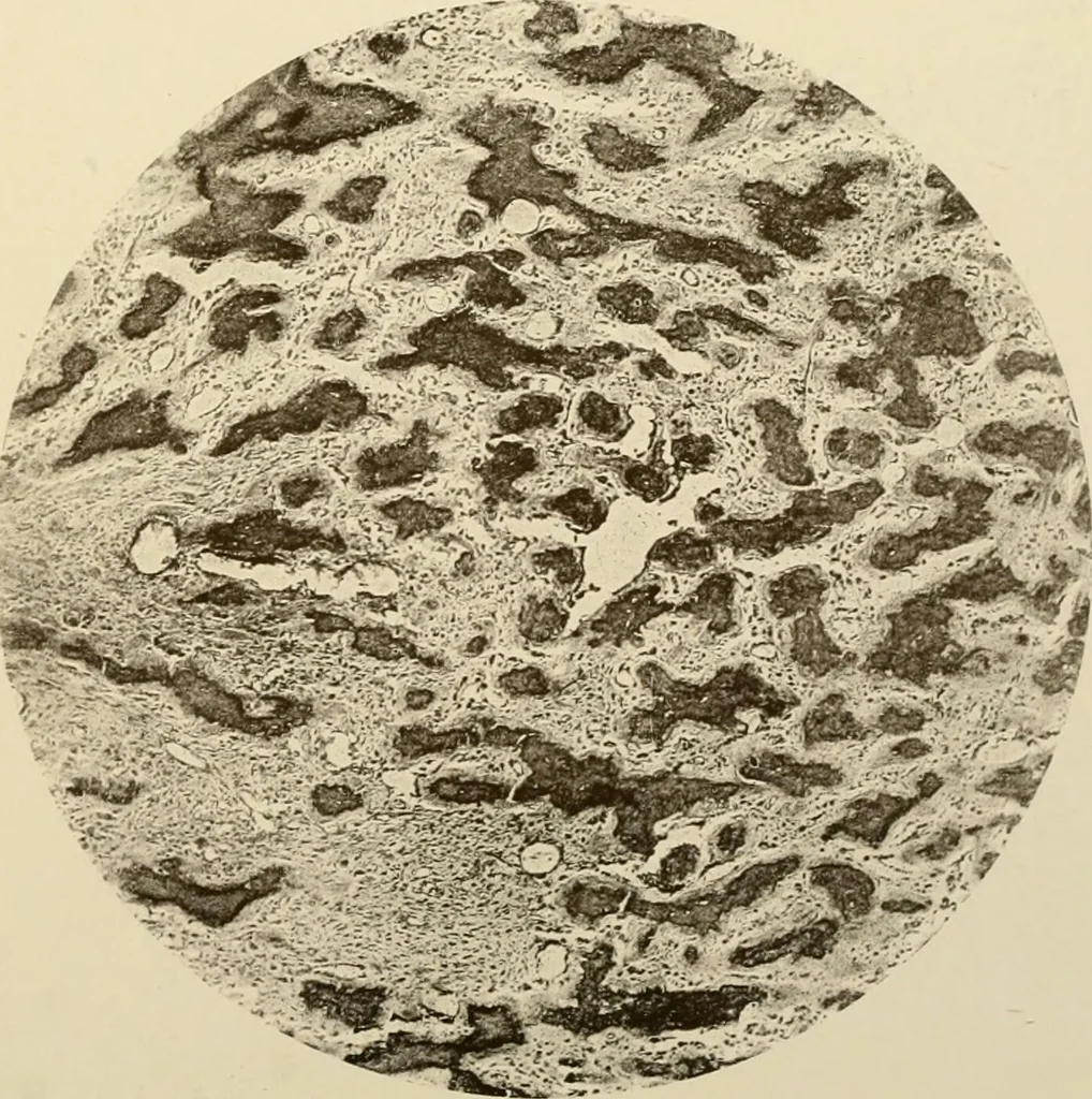 An illustration from The principles and practice of modern surgery / by Roswell Park ... with 722 engravings and 60 full-page plates in colors and monochrome., 1907, leaf 313