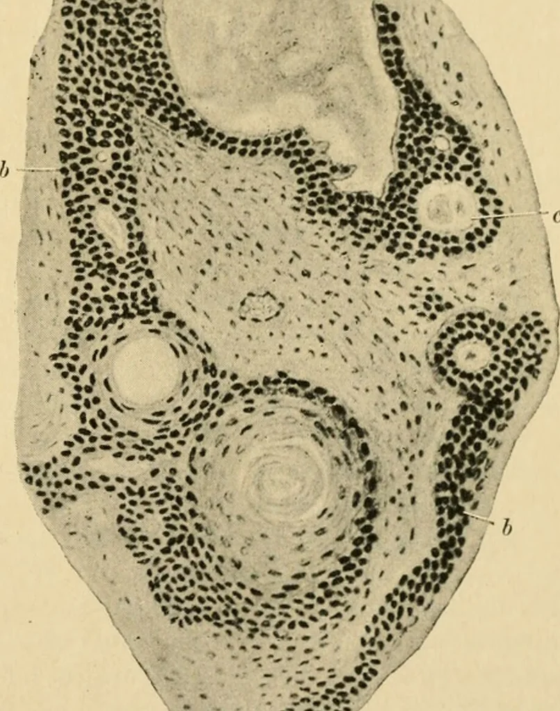 An illustration from The principles and practice of modern surgery / by Roswell Park ... with 722 engravings and 60 full-page plates in colors and monochrome., 1907, leaf 317