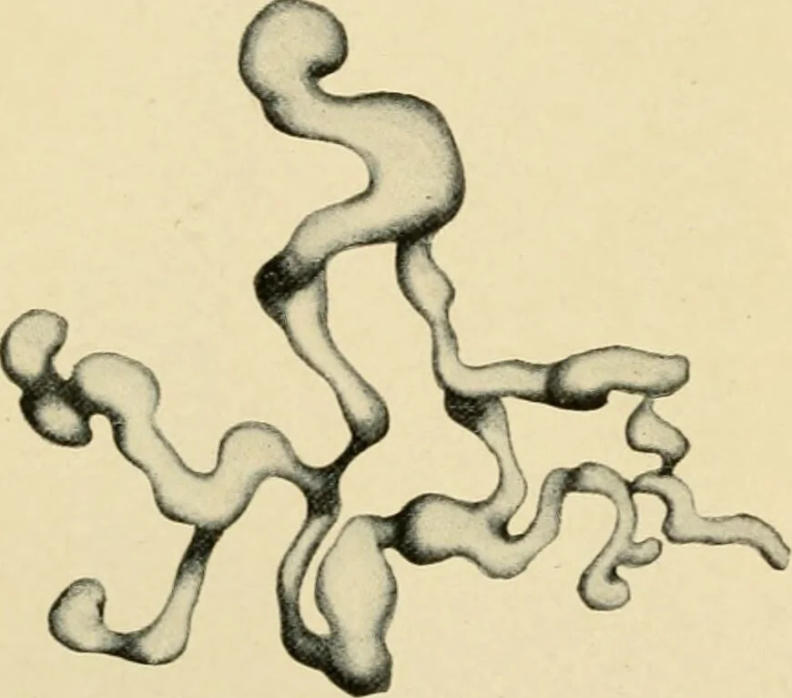 An illustration from The principles and practice of modern surgery / by Roswell Park ... with 722 engravings and 60 full-page plates in colors and monochrome., 1907, leaf 322