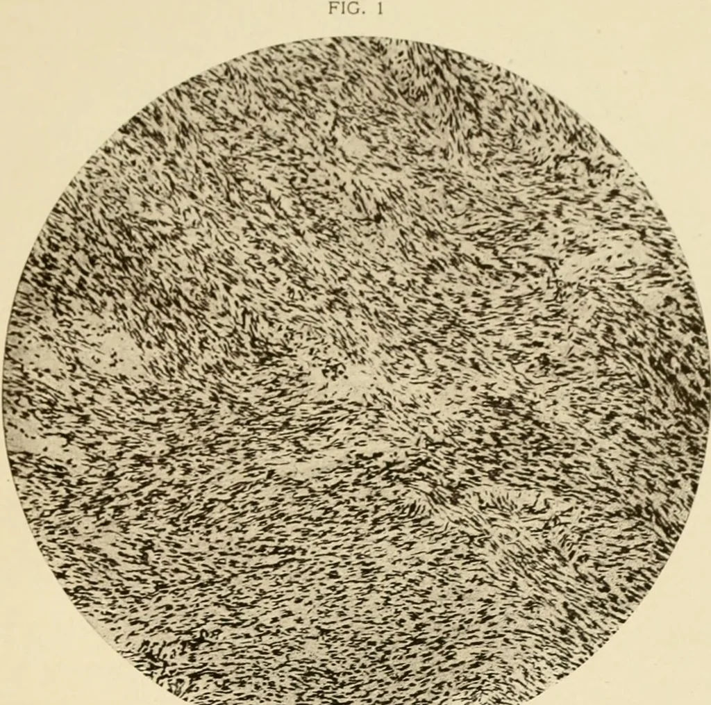 An illustration from The principles and practice of modern surgery / by Roswell Park ... with 722 engravings and 60 full-page plates in colors and monochrome., 1907, leaf 329