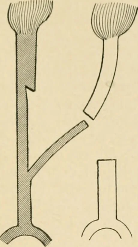 An illustration from The principles and practice of modern surgery / by Roswell Park ... with 722 engravings and 60 full-page plates in colors and monochrome., 1907, leaf 383