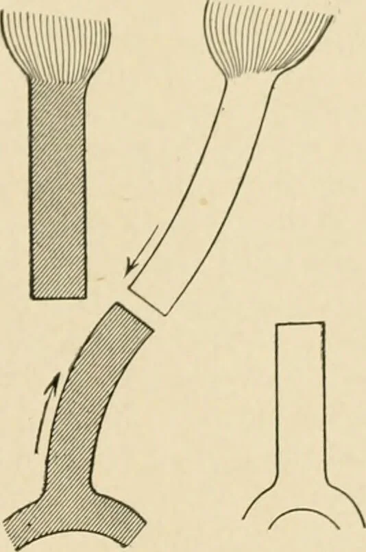 An illustration from The principles and practice of modern surgery / by Roswell Park ... with 722 engravings and 60 full-page plates in colors and monochrome., 1907, leaf 383