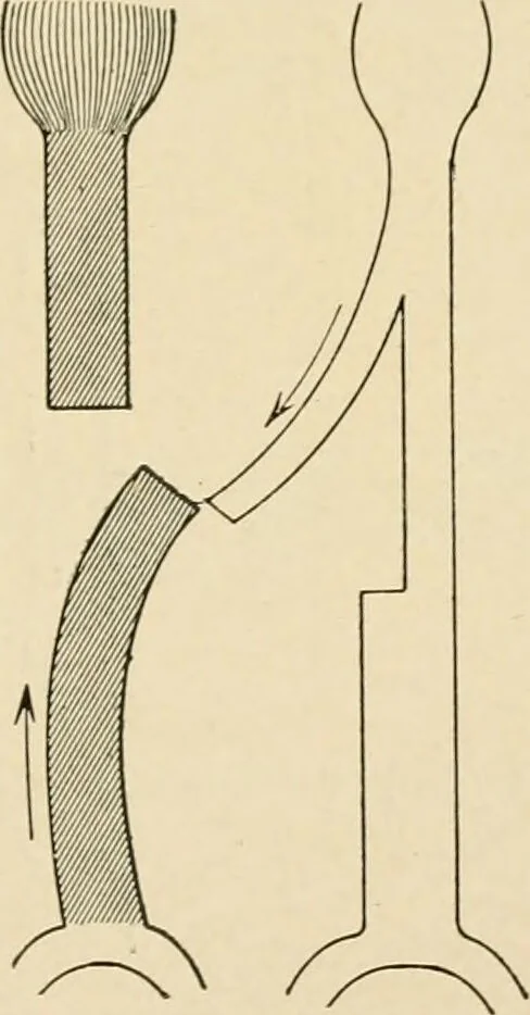 An illustration from The principles and practice of modern surgery / by Roswell Park ... with 722 engravings and 60 full-page plates in colors and monochrome., 1907, leaf 383