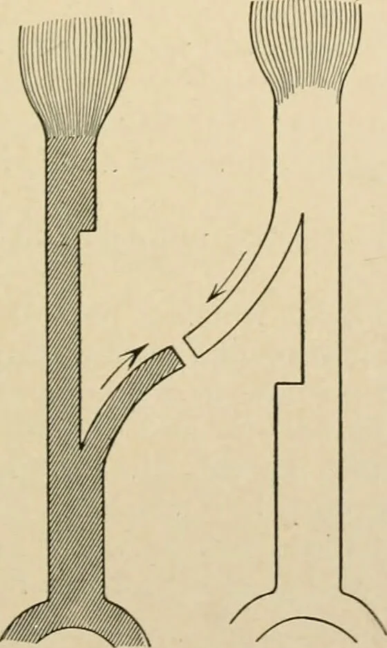 An illustration from The principles and practice of modern surgery / by Roswell Park ... with 722 engravings and 60 full-page plates in colors and monochrome., 1907, leaf 383