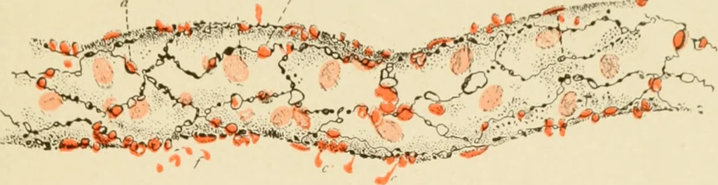 An illustration from The principles and practice of modern surgery / by Roswell Park ... with 722 engravings and 60 full-page plates in colors and monochrome., 1907, leaf 39