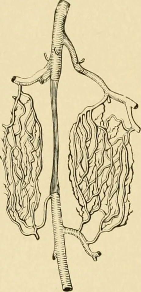 An illustration from The principles and practice of modern surgery / by Roswell Park ... with 722 engravings and 60 full-page plates in colors and monochrome., 1907, leaf 400