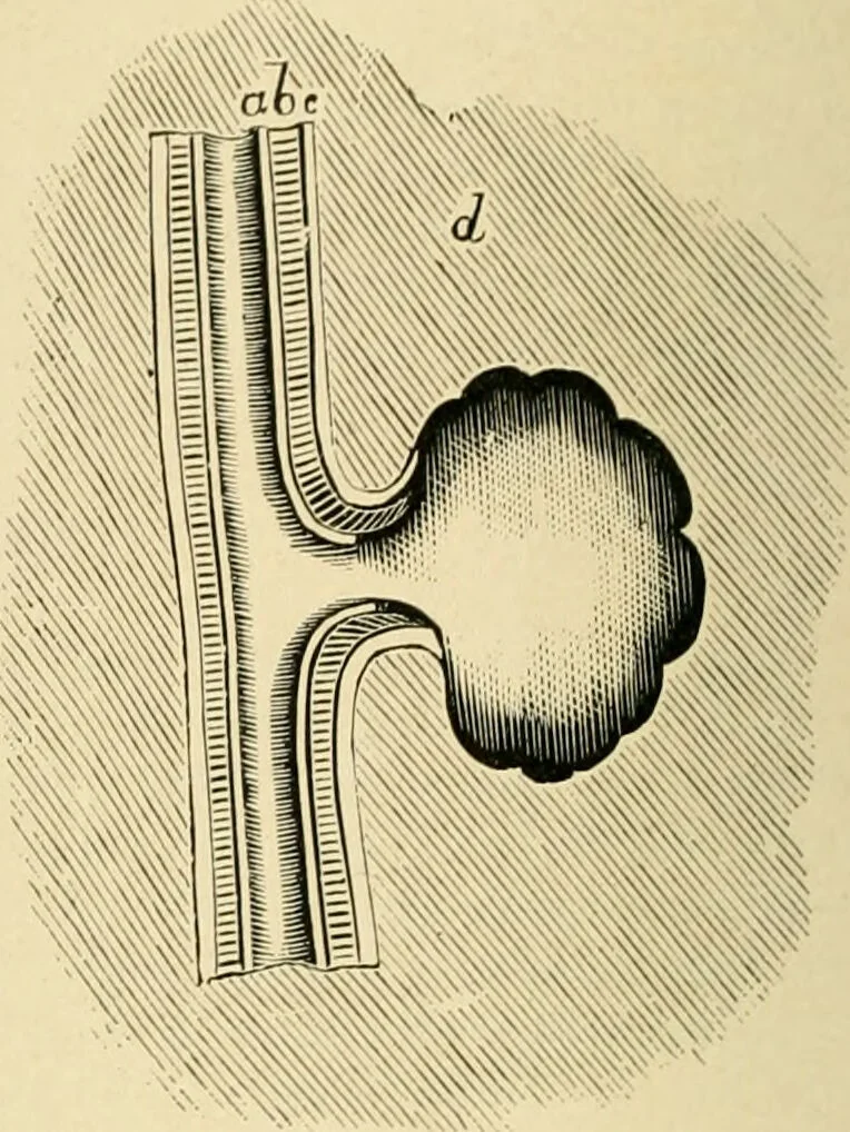 An illustration from The principles and practice of modern surgery / by Roswell Park ... with 722 engravings and 60 full-page plates in colors and monochrome., 1907, leaf 402