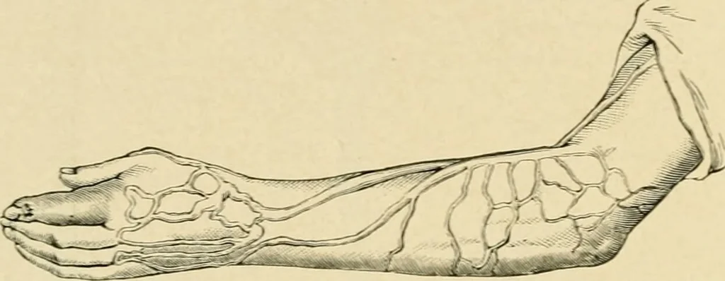 An illustration from The principles and practice of modern surgery / by Roswell Park ... with 722 engravings and 60 full-page plates in colors and monochrome., 1907, leaf 406