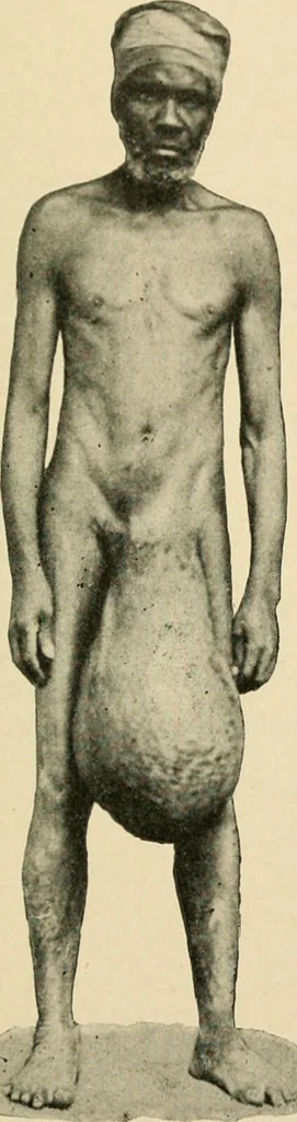 An illustration from The principles and practice of modern surgery / by Roswell Park ... with 722 engravings and 60 full-page plates in colors and monochrome., 1907, leaf 439