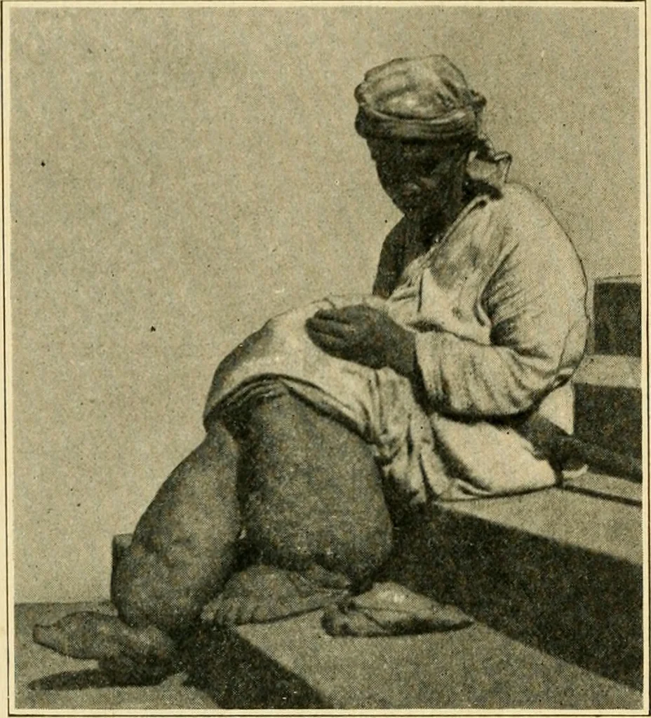 An illustration from The principles and practice of modern surgery / by Roswell Park ... with 722 engravings and 60 full-page plates in colors and monochrome., 1907, leaf 440