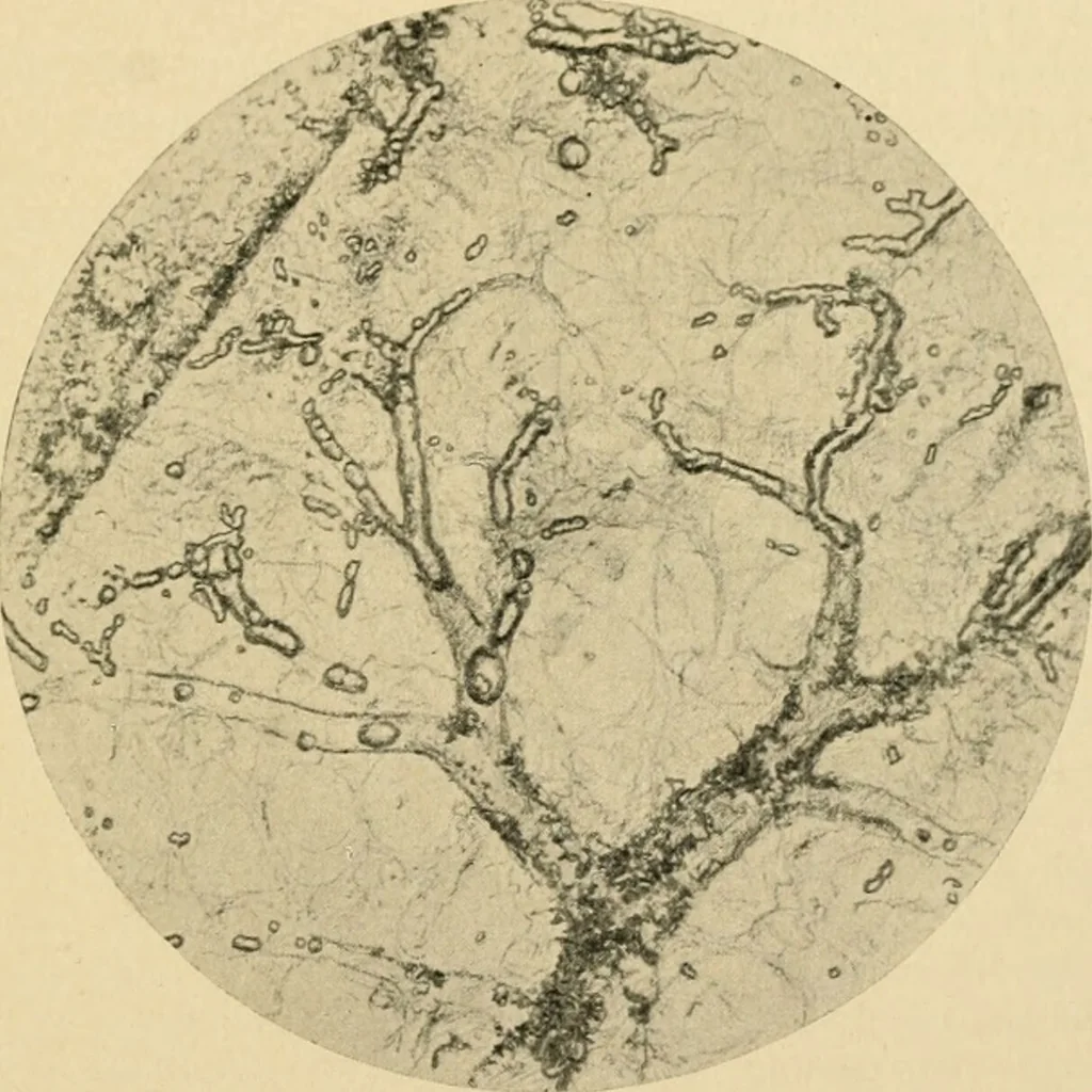 An illustration from The principles and practice of modern surgery / by Roswell Park ... with 722 engravings and 60 full-page plates in colors and monochrome., 1907, leaf 45