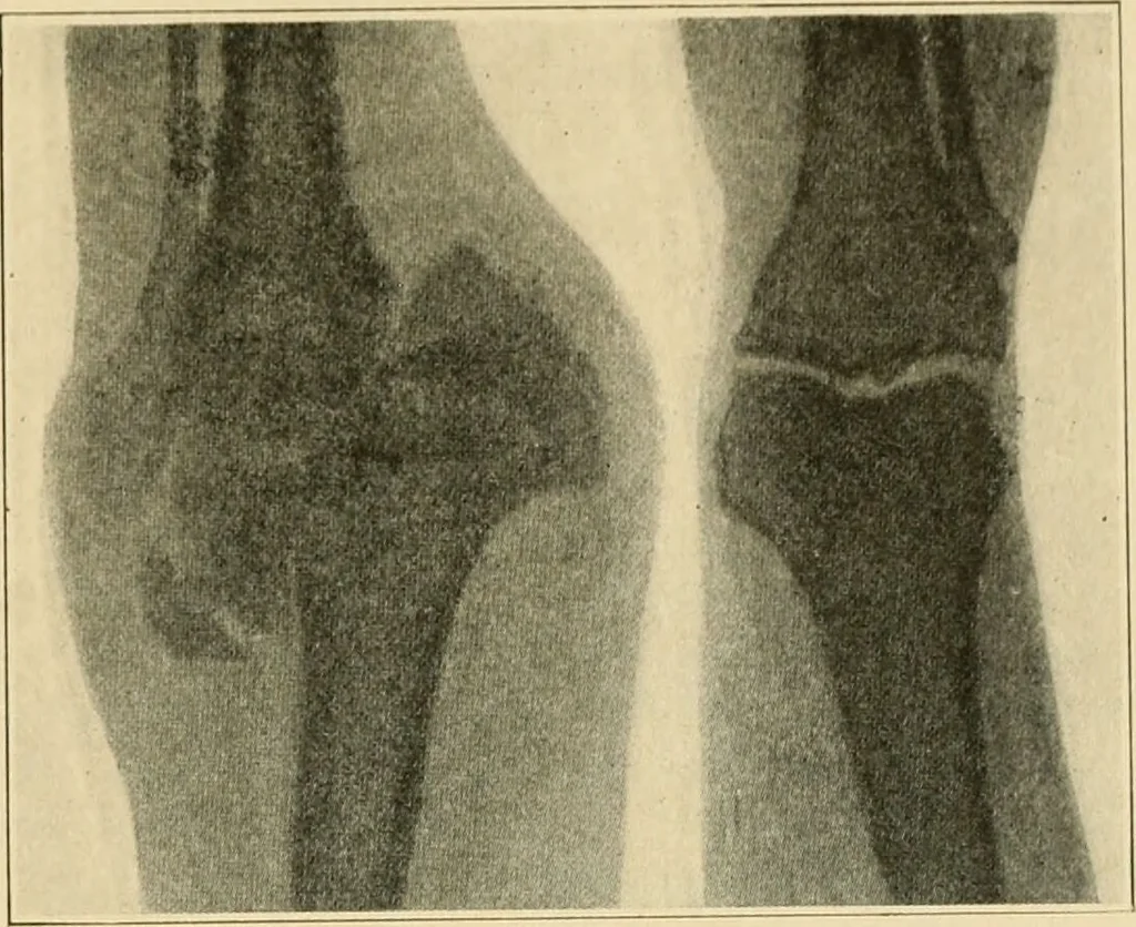 An illustration from The principles and practice of modern surgery / by Roswell Park ... with 722 engravings and 60 full-page plates in colors and monochrome., 1907, leaf 459