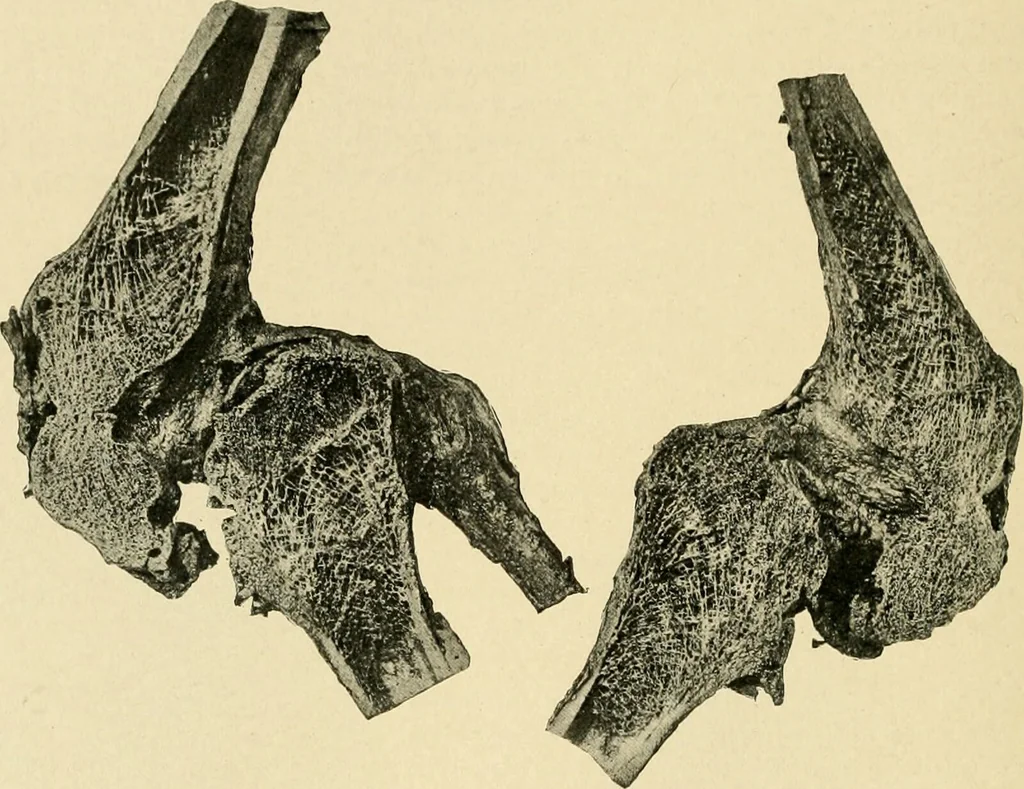 An illustration from The principles and practice of modern surgery / by Roswell Park ... with 722 engravings and 60 full-page plates in colors and monochrome., 1907, leaf 464