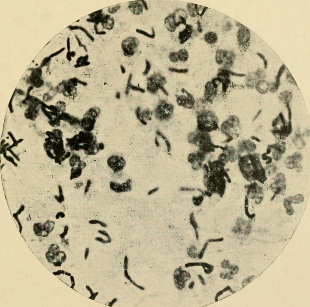 An illustration from The principles and practice of modern surgery / by Roswell Park ... with 722 engravings and 60 full-page plates in colors and monochrome., 1907, leaf 47